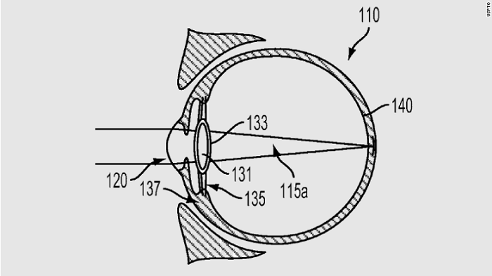 Google wants to inject cyborg lenses into your eyeballs